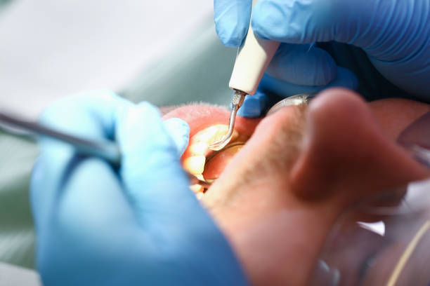 Best Chipped Tooth Repair Near Me  in Tamalpais Homestead Valley, CA