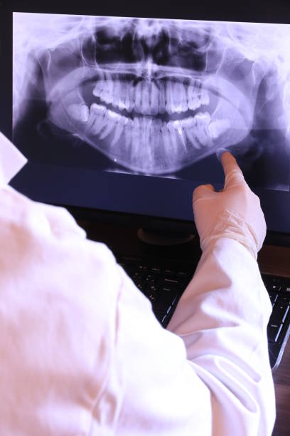 Best Chipped Tooth Repair Near Me  in Tamalpais Homestead Valley, CA
